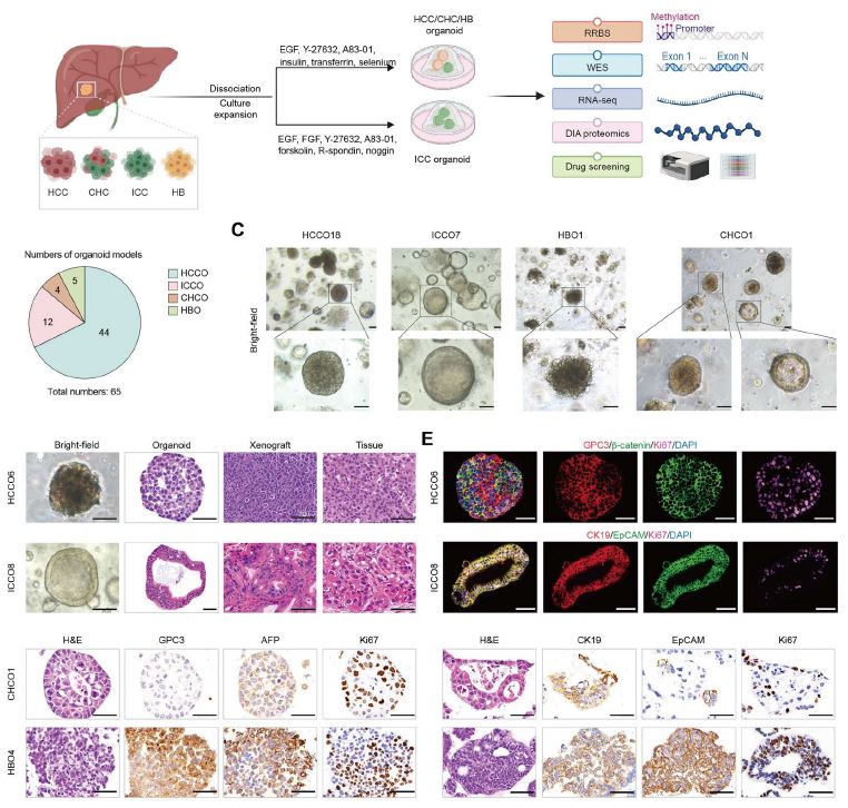 Image for project Liver Cancer Organoids