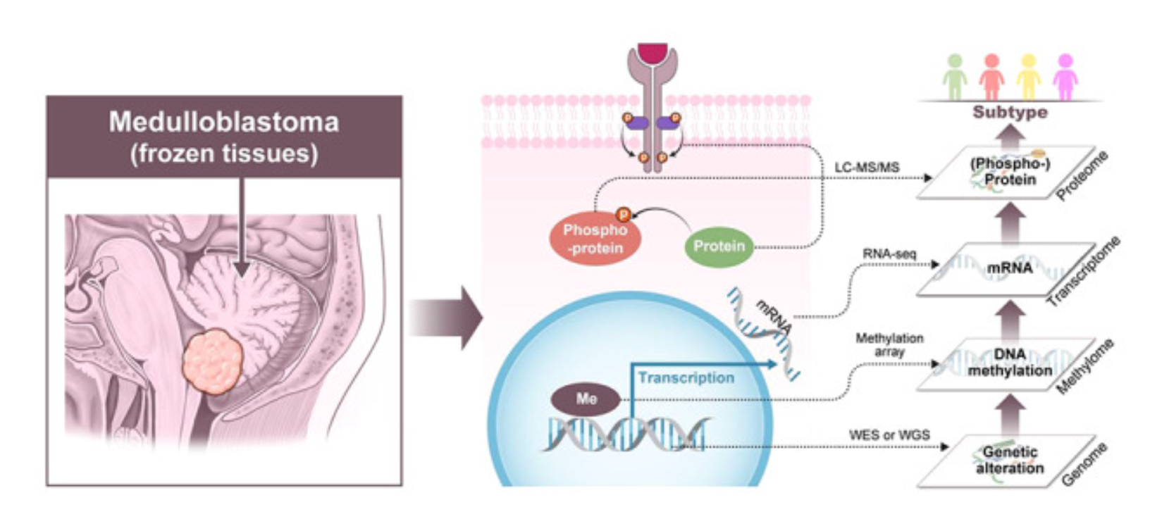 Image for project Medulloblastoma